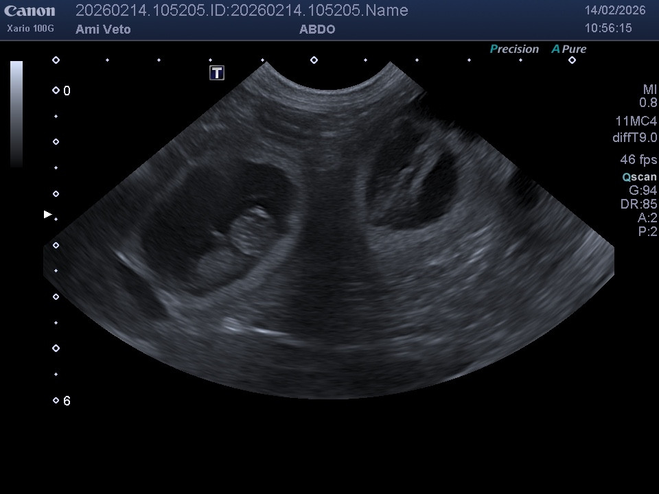 Gestation confirmée